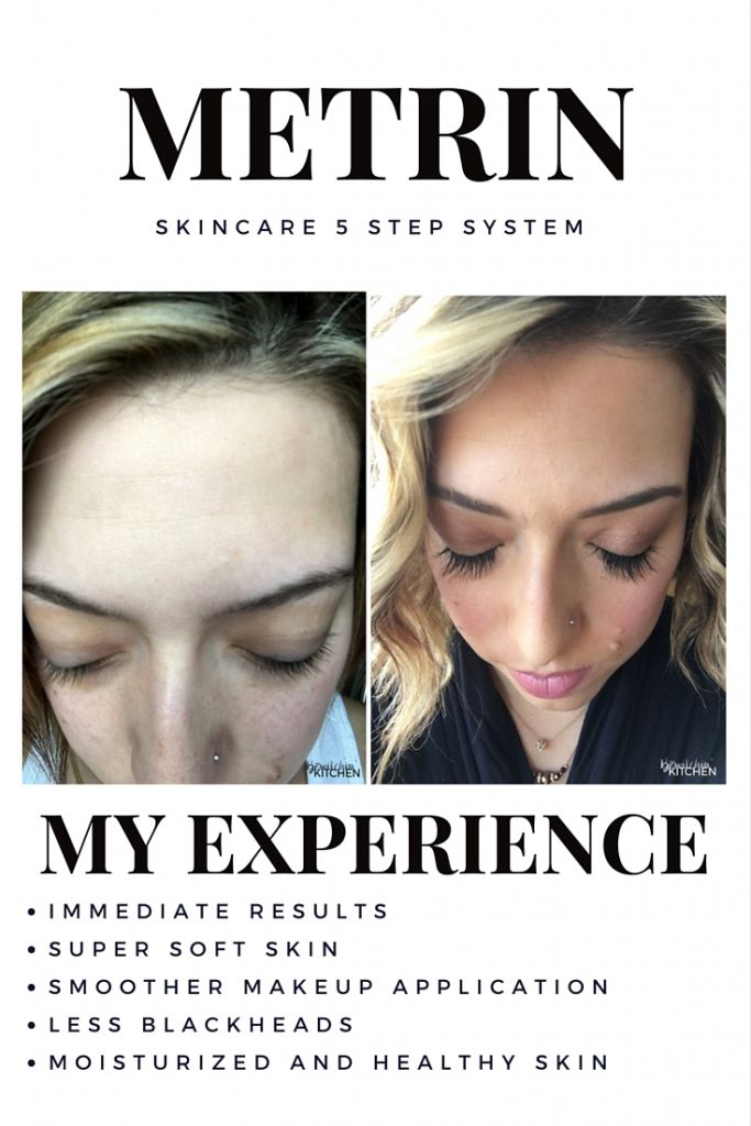 My two month experience with Metrin Skincare. This skincare system has left me with super soft skin, less blackheads and my makeup application is a lot smoother. Full review on the blog.